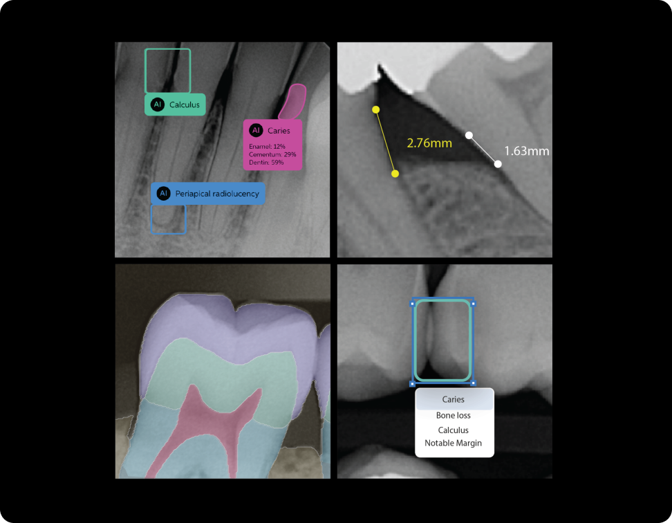Pearl ai fordentist